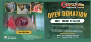 Bantu Yusuf Albaqir Melawan Tumor Tulang: Uluran Tangan Anda Sangat Berarti